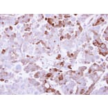 Immunohistochemistry - AKR1B10 antibody from Signalway Antibody (22305) - Antibodies.com