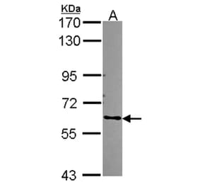 ARHGEF5 antibody from Signalway Antibody (22309) - Antibodies.com