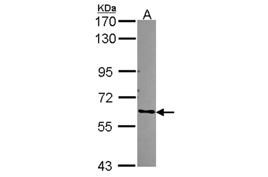 ARHGEF5 antibody from Signalway Antibody (22309) - Antibodies.com