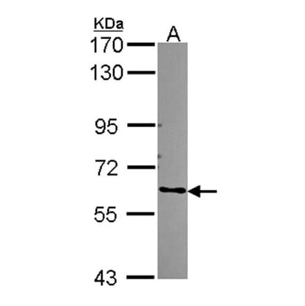 ARHGEF5 antibody from Signalway Antibody (22309) - Antibodies.com