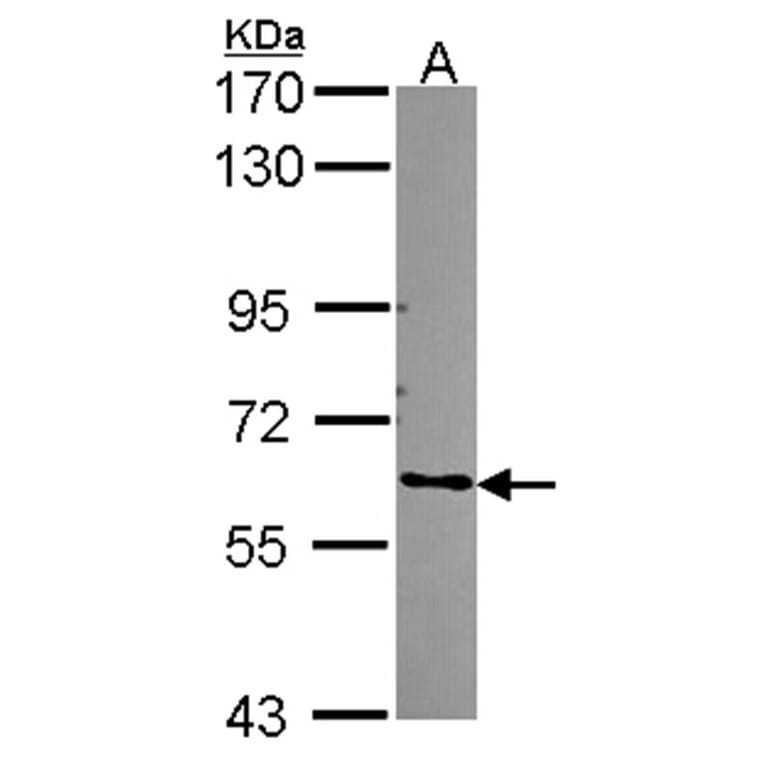 ARHGEF5 antibody from Signalway Antibody (22309) - Antibodies.com