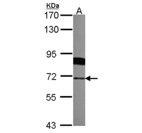 Radixin antibody from Signalway Antibody (22325) - Antibodies.com
