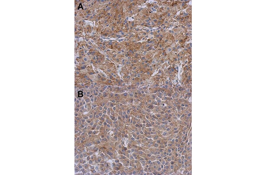 Immunohistochemistry - Radixin antibody from Signalway Antibody (22325) - Antibodies.com