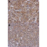 Immunohistochemistry - Radixin antibody from Signalway Antibody (22325) - Antibodies.com