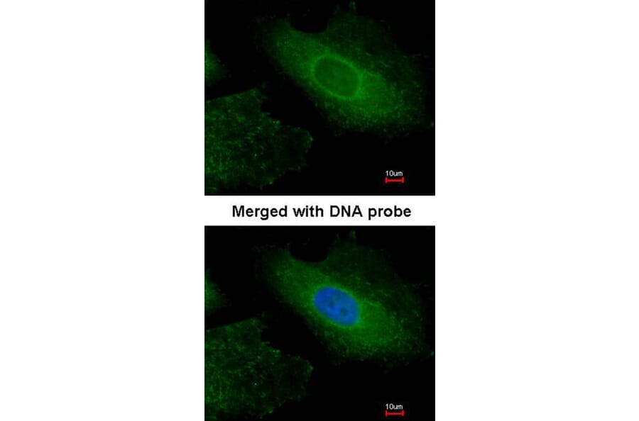 Immunofluorescence - Radixin antibody from Signalway Antibody (22325) - Antibodies.com