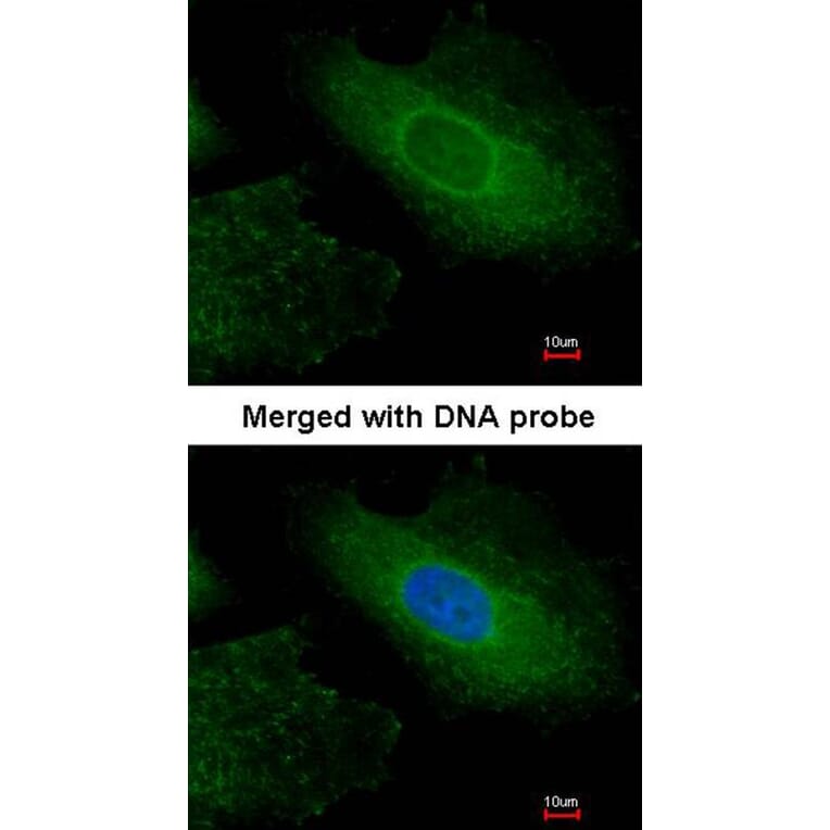 Immunofluorescence - Radixin antibody from Signalway Antibody (22325) - Antibodies.com