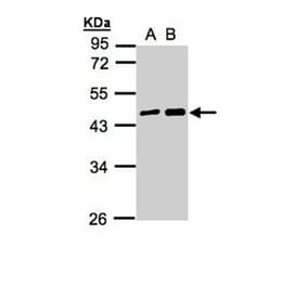 MAGEA11 antibody from Signalway Antibody (22350) - Antibodies.com