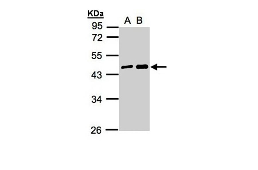 MAGEA11 antibody from Signalway Antibody (22350) - Antibodies.com