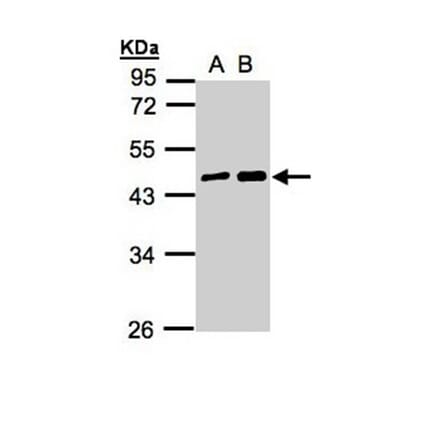 MAGEA11 antibody from Signalway Antibody (22350) - Antibodies.com