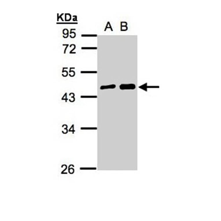 MAGEA11 antibody from Signalway Antibody (22350) - Antibodies.com