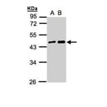 MAGEA11 antibody from Signalway Antibody (22350) - Antibodies.com