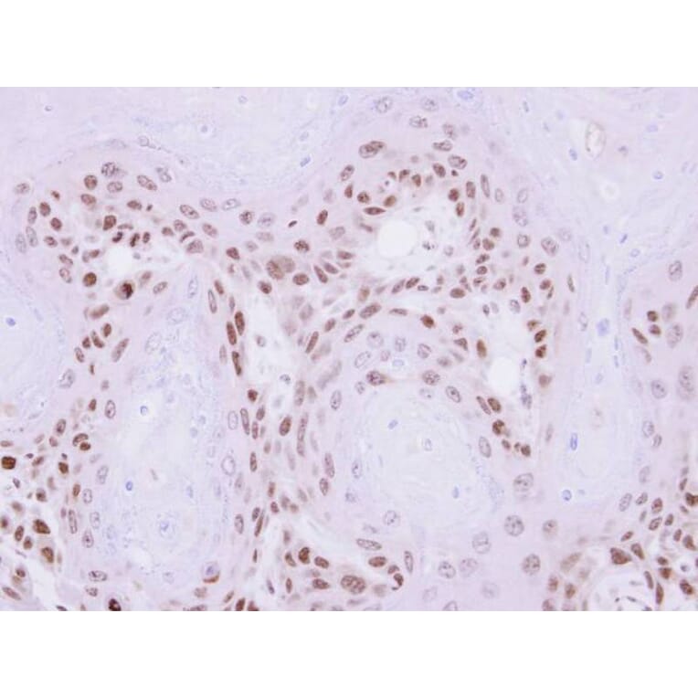 Immunohistochemistry - MAGEA11 antibody from Signalway Antibody (22350) - Antibodies.com