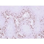 Immunohistochemistry - MAGEA11 antibody from Signalway Antibody (22350) - Antibodies.com