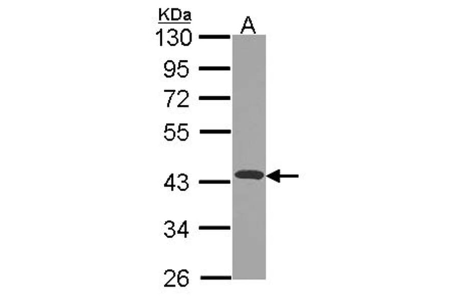 NDUFA10 antibody from Signalway Antibody (22430) - Antibodies.com