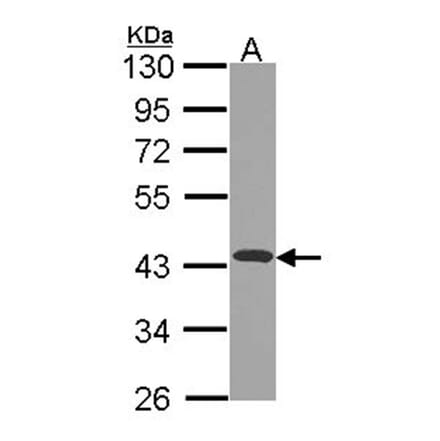 NDUFA10 antibody from Signalway Antibody (22430) - Antibodies.com