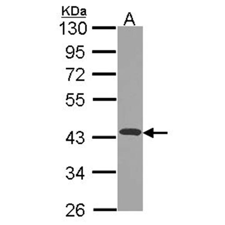 NDUFA10 antibody from Signalway Antibody (22430) - Antibodies.com