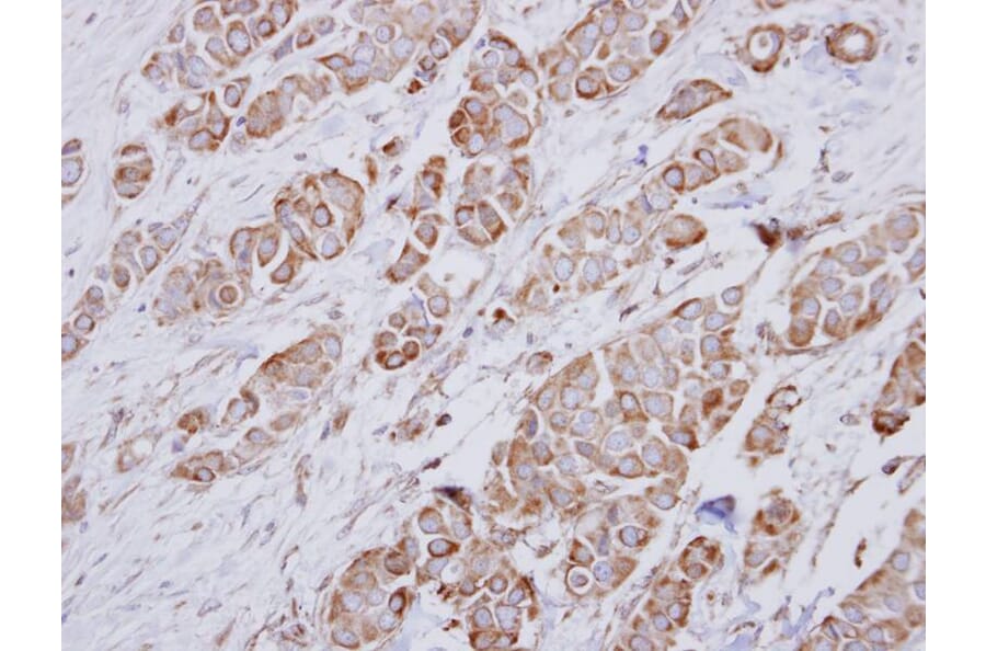 Immunohistochemistry - NDUFA10 antibody from Signalway Antibody (22430) - Antibodies.com