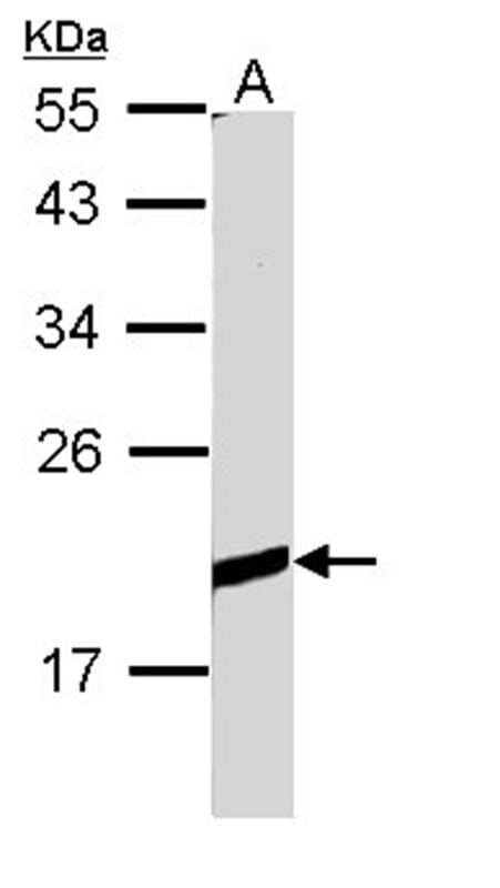 Sample (30 µg of whole cell lysate)  Raji 12% SDS PAGE Primary antibody diluted at 1: 1000