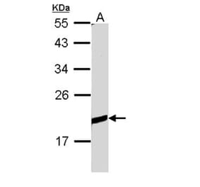 BCL2L10 antibody from Signalway Antibody (22559) - Antibodies.com