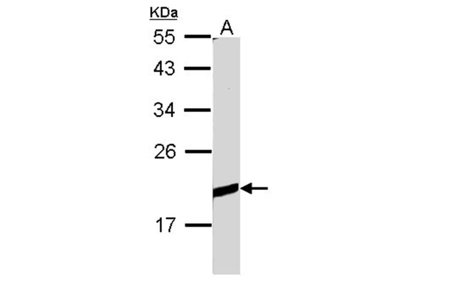 BCL2L10 antibody from Signalway Antibody (22559) - Antibodies.com