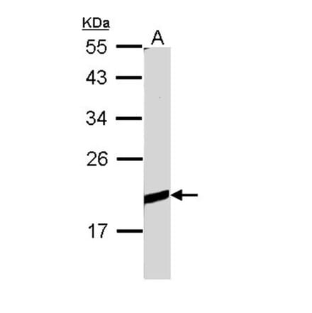 BCL2L10 antibody from Signalway Antibody (22559) - Antibodies.com