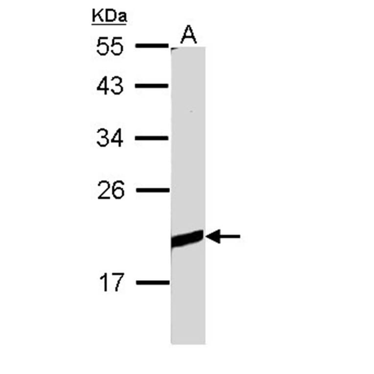 BCL2L10 antibody from Signalway Antibody (22559) - Antibodies.com