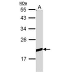 BCL2L10 antibody from Signalway Antibody (22559) - Antibodies.com