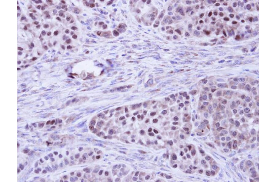 Immunohistochemistry - BCL2L10 antibody from Signalway Antibody (22559) - Antibodies.com