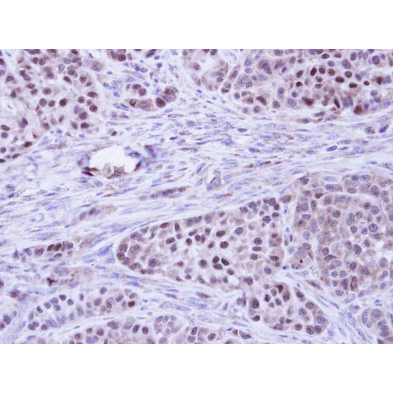 Immunohistochemistry - BCL2L10 antibody from Signalway Antibody (22559) - Antibodies.com