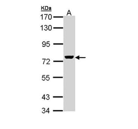 ZC3H12A antibody from Signalway Antibody (22601) - Antibodies.com