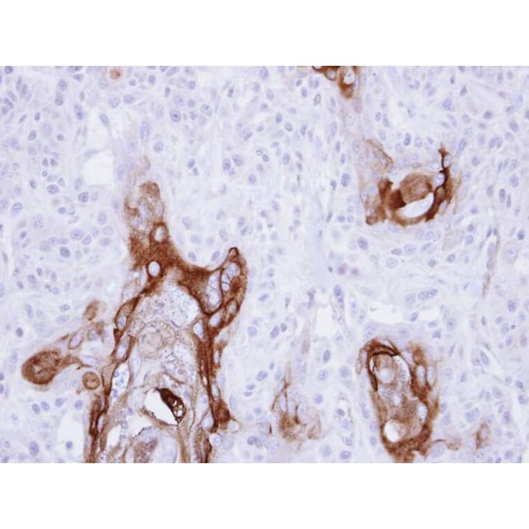 Immunohistochemistry - ZC3H12A antibody from Signalway Antibody (22601) - Antibodies.com