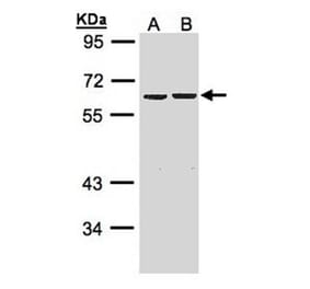 ZNF306 antibody from Signalway Antibody (22625) - Antibodies.com
