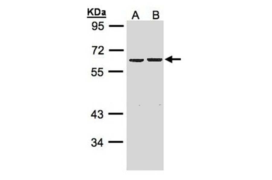 ZNF306 antibody from Signalway Antibody (22625) - Antibodies.com