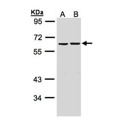 ZNF306 antibody from Signalway Antibody (22625) - Antibodies.com