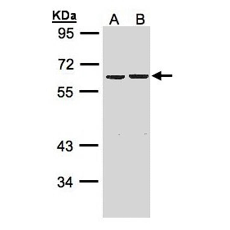 ZNF306 antibody from Signalway Antibody (22625) - Antibodies.com