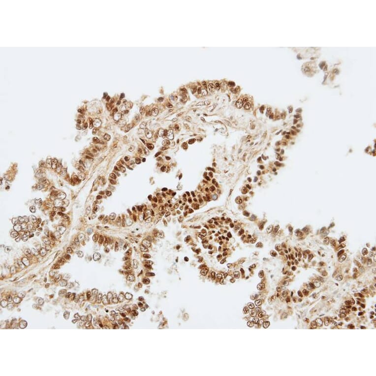 Immunohistochemistry - ZNF306 antibody from Signalway Antibody (22625) - Antibodies.com