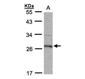 15-PGDH antibody from Signalway Antibody (22626) - Antibodies.com