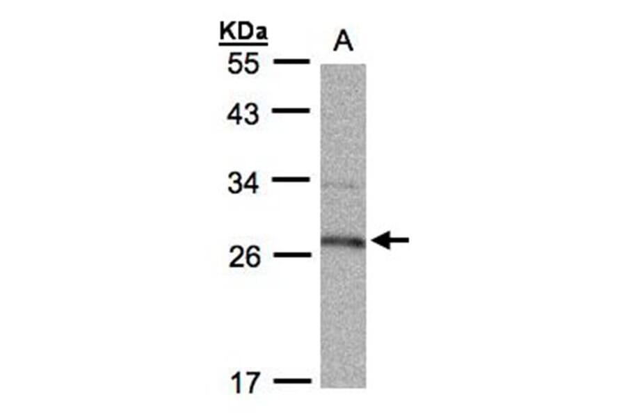 15-PGDH antibody from Signalway Antibody (22626) - Antibodies.com