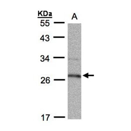 15-PGDH antibody from Signalway Antibody (22626) - Antibodies.com