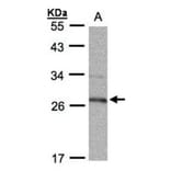 15-PGDH antibody from Signalway Antibody (22626) - Antibodies.com