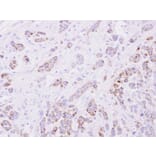 Immunohistochemistry - 15-PGDH antibody from Signalway Antibody (22626) - Antibodies.com