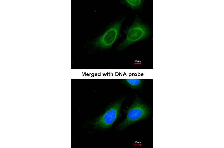 Immunofluorescence - 15-PGDH antibody from Signalway Antibody (22626) - Antibodies.com