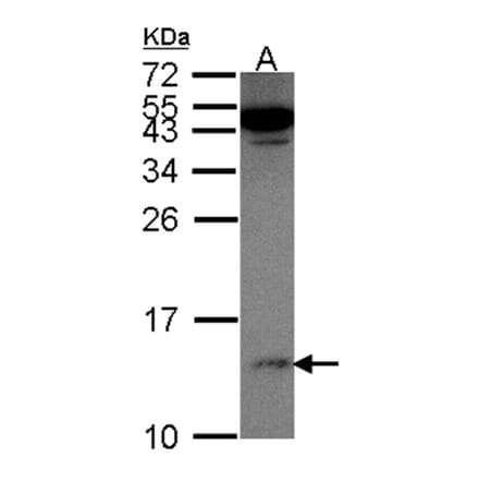 S100A11 antibody from Signalway Antibody (22797) - Antibodies.com