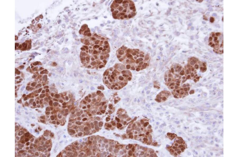 Immunohistochemistry - S100A11 antibody from Signalway Antibody (22797) - Antibodies.com
