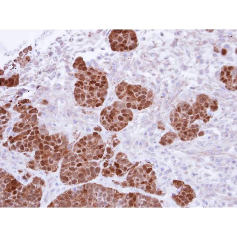 Immunohistochemistry - S100A11 antibody from Signalway Antibody (22797) - Antibodies.com