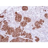 Immunohistochemistry - S100A11 antibody from Signalway Antibody (22797) - Antibodies.com