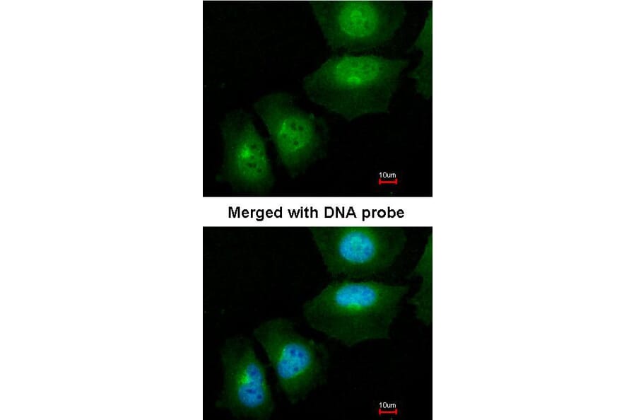 Immunofluorescence - S100A11 antibody from Signalway Antibody (22797) - Antibodies.com