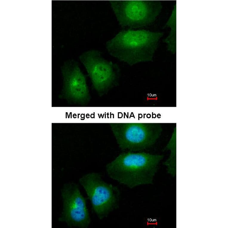 Immunofluorescence - S100A11 antibody from Signalway Antibody (22797) - Antibodies.com