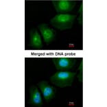 Immunofluorescence - S100A11 antibody from Signalway Antibody (22797) - Antibodies.com