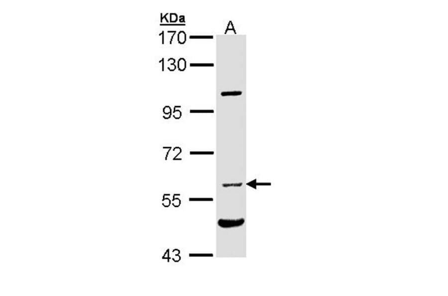 NPR-C antibody from Signalway Antibody (22809) - Antibodies.com